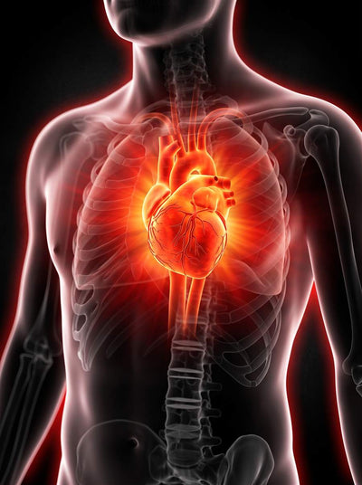 High Blood Pressure