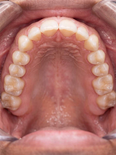 Facial Development