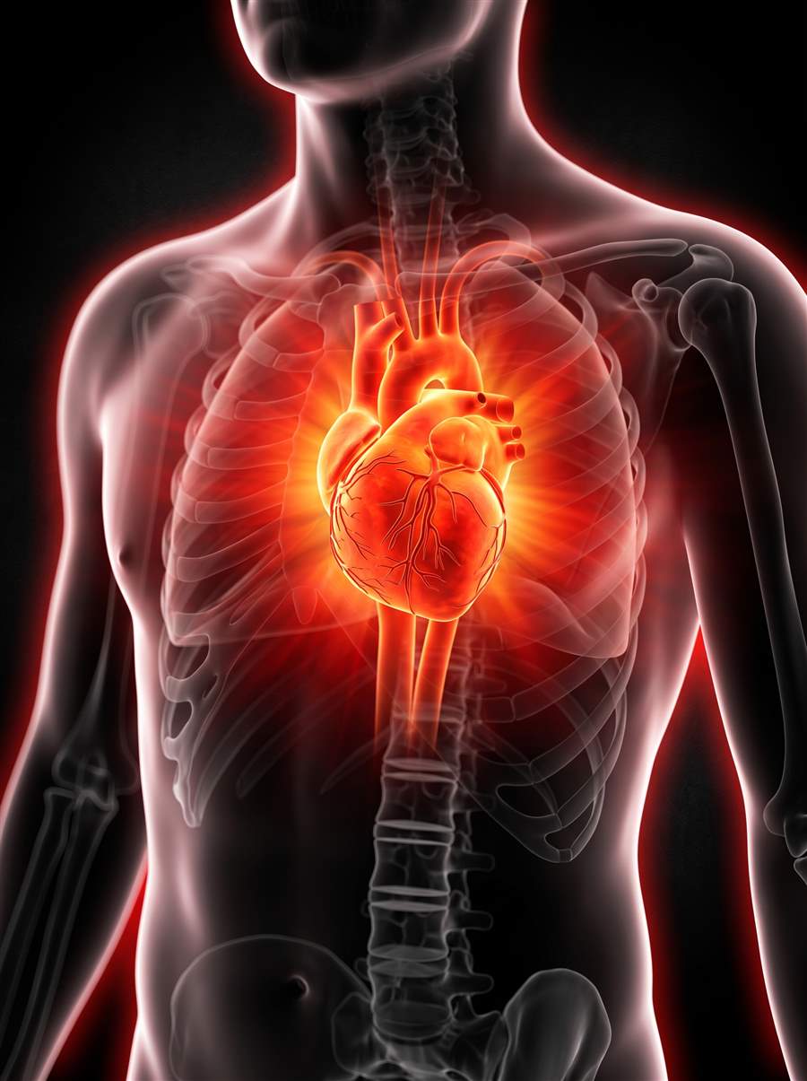 High Blood Pressure