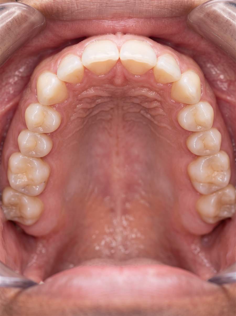 Facial Development